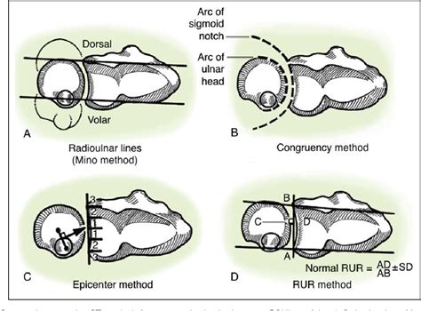 druj rescue procedure